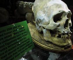 human skull