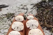 A person is sitting on a sandy beach with several sand dollars placed on their knees.